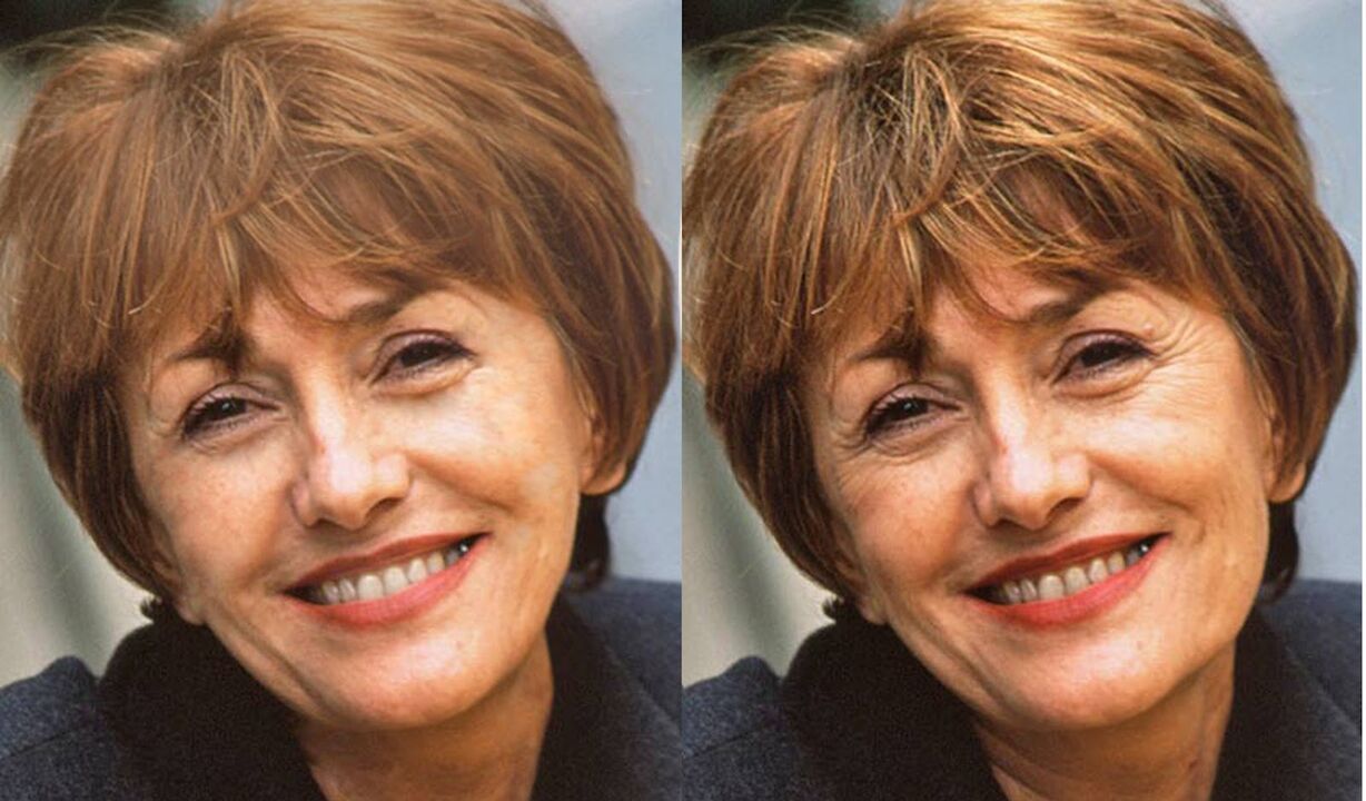 face before and after contour photo